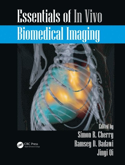 Jinyi Qi, Ramsey D. Badawi, Simon R. Cherry - Essentials of In Vivo Biomedical Imaging, E-bok. Tillgänglighet: Lägg i varukorg