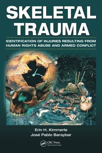 Jose Pablo Baraybar, Erin H. Kimmerle - Skeletal Trauma, E-bok. Tillgänglighet: Lägg i varukorg
