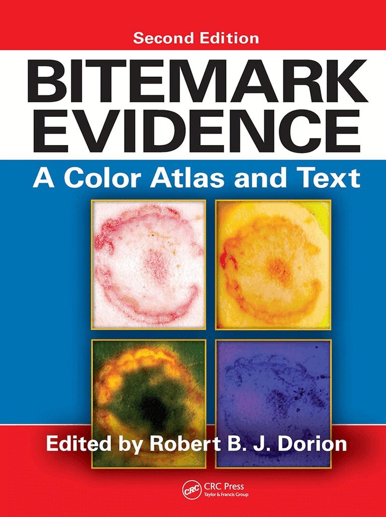Robert B.J. Dorion - Bitemark Evidence, E-bok