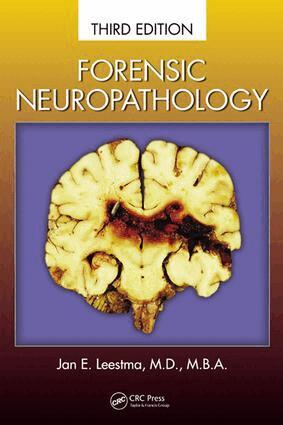 Jan E. Leestma - Forensic Neuropathology, E-bok. Tillgänglighet: Lägg i varukorg