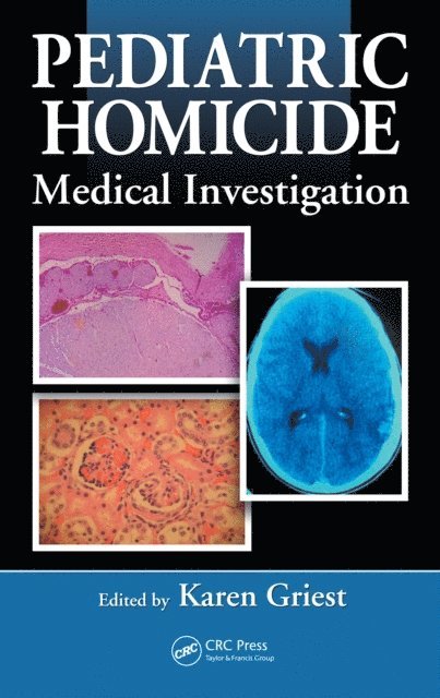 Pediatric Homicide