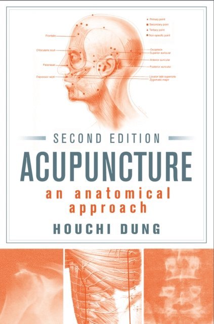 Houchi Dung - Acupuncture, E-bok
