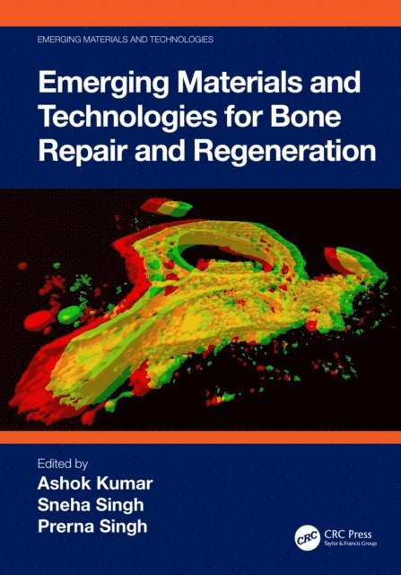 Prerna Singh, Sneha Singh, Ashok Kumar - Emerging Materials and Technologies for Bone Repair and Regeneration, E-bok