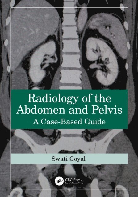 Swati Goyal - Radiology of the Abdomen and Pelvis, E-bok. Tillgänglighet: Lägg i varukorg