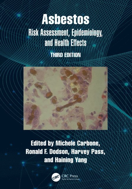 Haining Yang, Harvey Pass, Ronald Dodson, Michele Carbone - Asbestos, E-bok