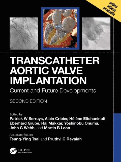 Martin B. Leon, John G. Webb, Yoshinobu Onuma, Raj Makkar, Eberhard Grube, Helene Eltchaninoff, Alain Cribier, Patrick W. Serruys - Transcatheter Aortic Valve Implantation, E-bok