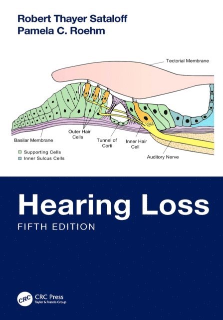 Pamela C. Roehm, Robert Thayer Sataloff - Hearing Loss, E-bok
