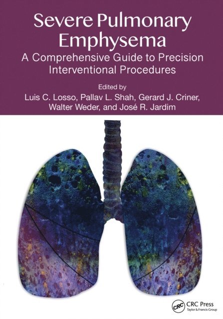 Jose R Jardim, Walter Weder, Gerald J. Criner, Pallav L. Shah, Luis C. Losso - Severe Pulmonary Emphysema:, E-bok