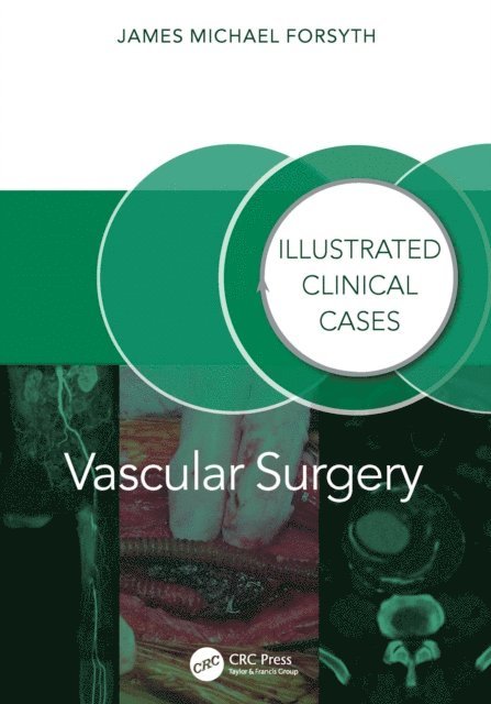James Forsyth - Vascular Surgery:, E-bok