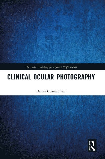 Denise Cunningham - Clinical Ocular Photography, E-bok