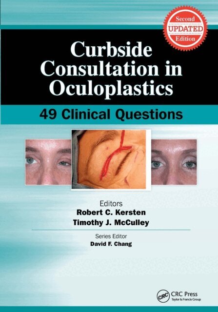 Timothy McCulley, Robert Kersten - Curbside Consultation in Oculoplastics, E-bok