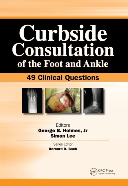 Simon Lee, George Holmes - Curbside Consultation of the Foot and Ankle, E-bok