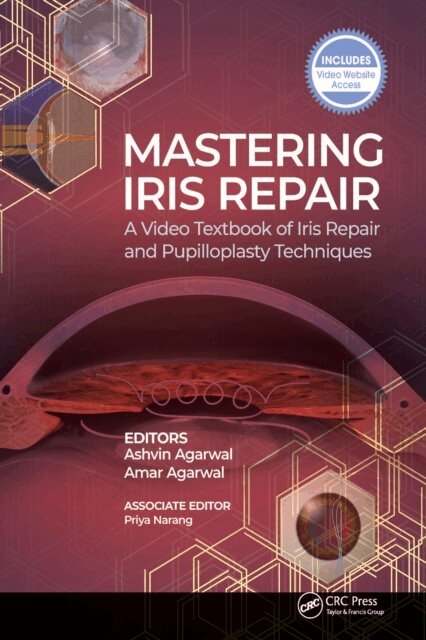Amar Agarwal, Ashvin Agarwal - Mastering Iris Repair, E-bok