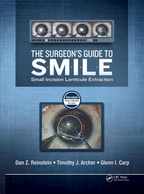 Surgeon's Guide to SMILE