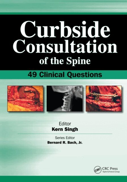 Ken Singh - Curbside Consultation of the Spine, E-bok