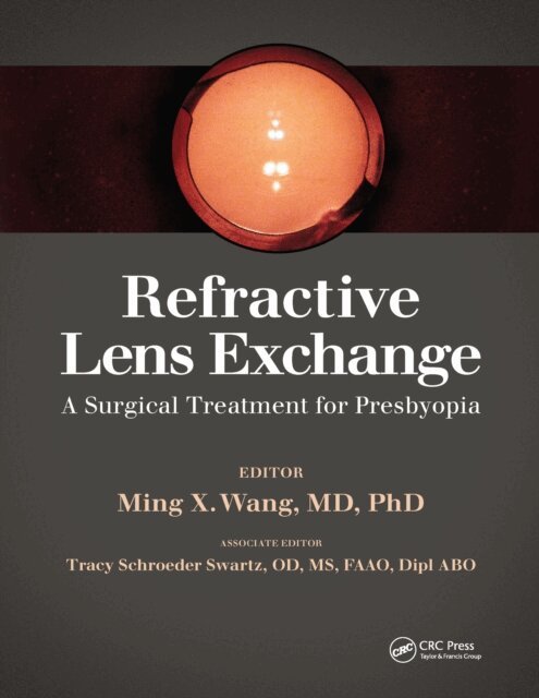 Ming Wang - Refractive Lens Exchange, E-bok