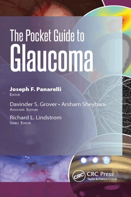 Arsham Sheybani, Davinder Grover, Joseph Panarelli - Pocket Guide to Glaucoma, E-bok