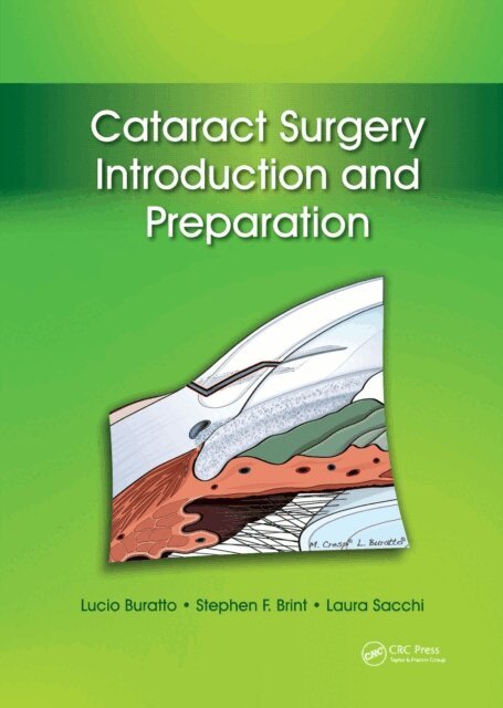 Laura Sacchi, Stephen Brint, Lucio Buratto - Cataract Surgery, E-bok. Tillgänglighet: Lägg i varukorg