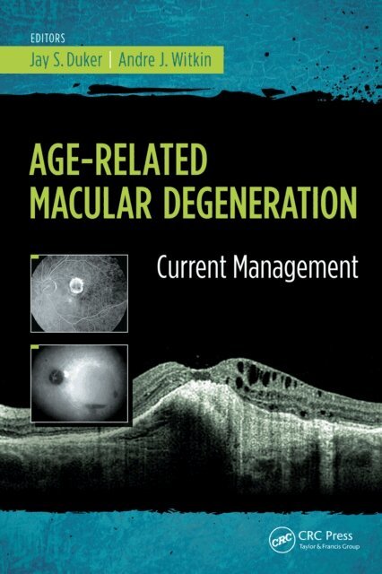Andre Witkin, Jay Duker - Age-Related Macular Degeneration, E-bok