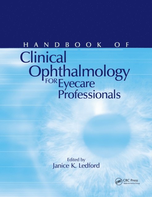 Janice K. Ledford - Handbook of Clinical Ophthalmology for Eyecare Professionals, E-bok