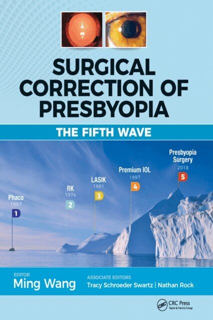 Ming Wang - Surgical Correction of Presbyopia, E-bok