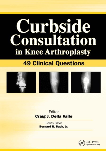 Craig Della Valle - Curbside Consultation in Knee Arthroplasty, E-bok