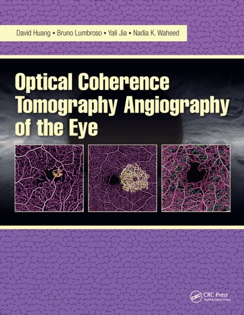 Nadia Waheed, Yali Jia, Bruno Lumbroso, David Huang - Optical Coherence Tomography Angiography of the Eye, E-bok