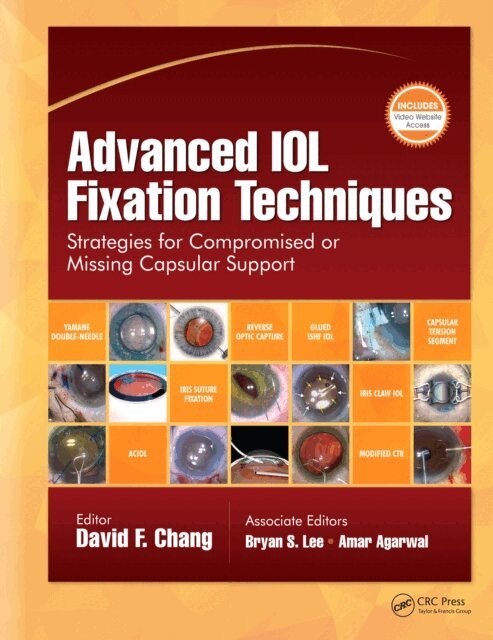 David F. Chang - Advanced IOL Fixation Techniques, E-bok