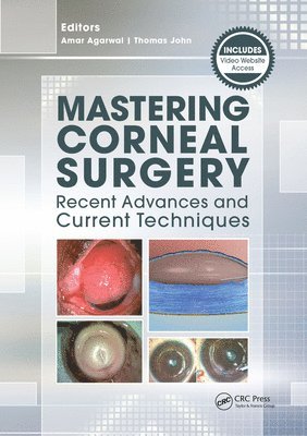 Thomas John, Amar Agarwal - Mastering Corneal Surgery, E-bok
