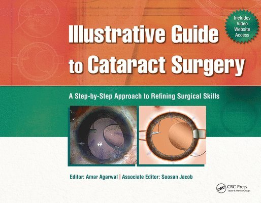 Amar Agarwal - Illustrative Guide to Cataract Surgery, E-bok