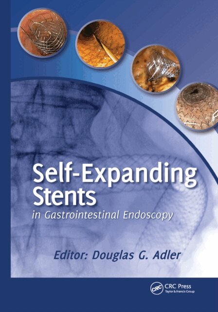 Douglas Adler - Self-Expanding Stents in Gastrointestinal Endoscopy, E-bok