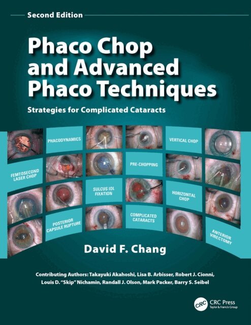 David F. Chang - Phaco Chop and Advanced Phaco Techniques, E-bok