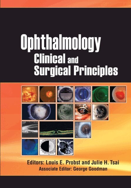 Julie Tsai, Louis Probst - Ophthalmology, E-bok. Tillgänglighet: Lägg i varukorg