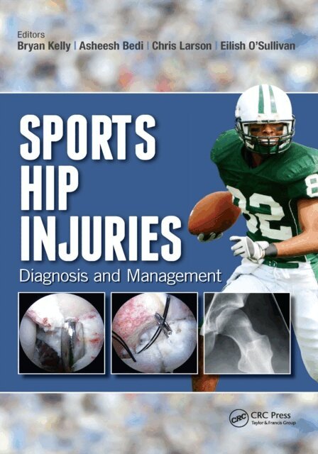 Eilish O'Sullivan, Chris Larson, Asheesh Bedi, Bryan Kelly - Sports Hip Injuries, E-bok