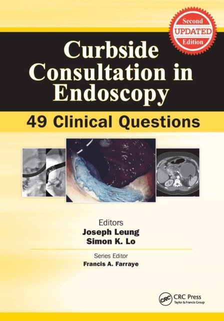 Simon K. Lo, Joseph Leung - Curbside Consultation in Endoscopy, E-bok