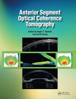 David Huang, Roger Steinert - Anterior Segment Optical Coherence Tomography, E-bok