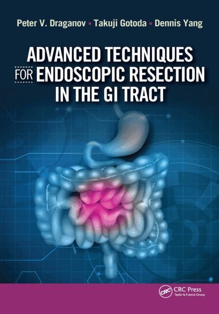 Dennis Yang, Takuji Gotoda, Peter Draganov - Advanced Techniques for Endoscopic Resection in the GI Tract, E-bok