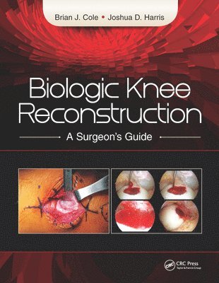 Joshua Harris, Brian Cole - Biologic Knee Reconstruction, E-bok