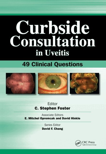 Stephen Foster - Curbside Consultation in Uveitis, E-bok