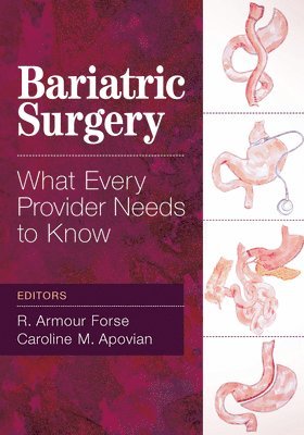 Caroline Apovian, R. Armour Forse - Bariatric Surgery, E-bok