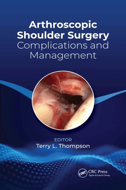 Terry Thompson - Arthroscopic Shoulder Surgery, E-bok. Tillgänglighet: Lägg i varukorg