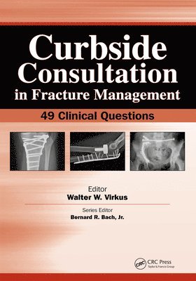 Walter Virkus - Curbside Consultation in Fracture Management, E-bok