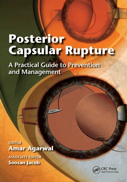 Amar Agarwal - Posterior Capsular Rupture, E-bok
