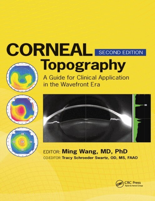 Ming Wang - Corneal Topography, E-bok