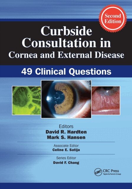 Celine Satija, Mark Hansen, David R. Hardten - Curbside Consultation in Cornea and External Disease, E-bok