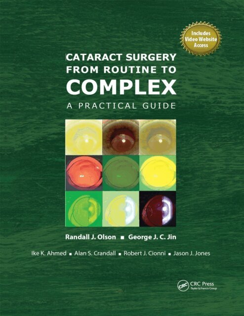 Alan Crandall, Ike Ahmed, George Jin, Randall Olson - Cataract Surgery from Routine to Complex, E-bok. Tillgänglighet: Lägg i varukorg