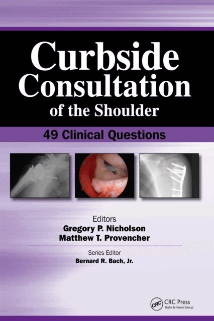 Matthew Provencher, Gregory Nicholson - Curbside Consultation of the Shoulder, E-bok