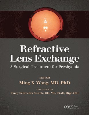 Ming Wang - Refractive Lens Exchange, E-bok