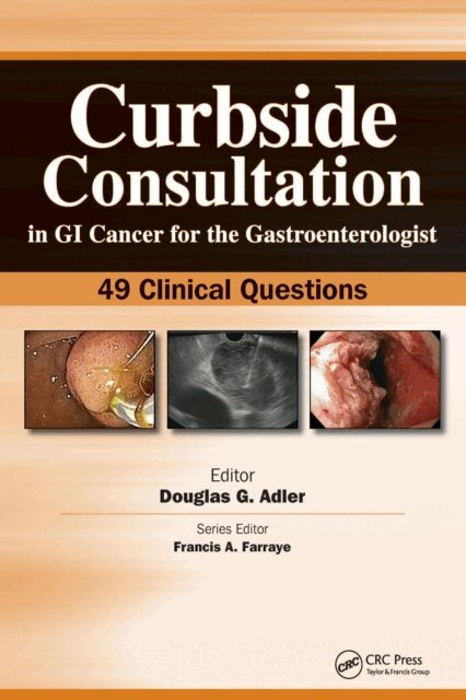 Douglas Adler - Curbside Consultation in GI Cancer for the Gastroenterologist, E-bok