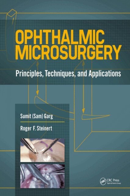 Roger Steinert, Sumit Garg - Ophthalmic Microsurgery, E-bok